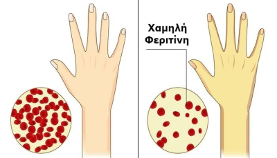 Κούραση, αδυναμία, θολούρα: Τα σημάδια χαμηλής φεριτίνης που δεν πρέπει να αγνοείς